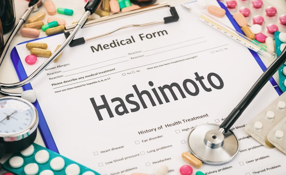 Choroba Hashimoto a odchudzanie